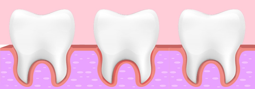 7.Which color your gums are