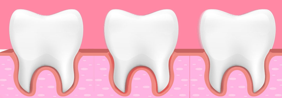 7.Which color your gums are