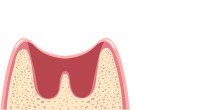 8.Are your teeth wobbly or lose?